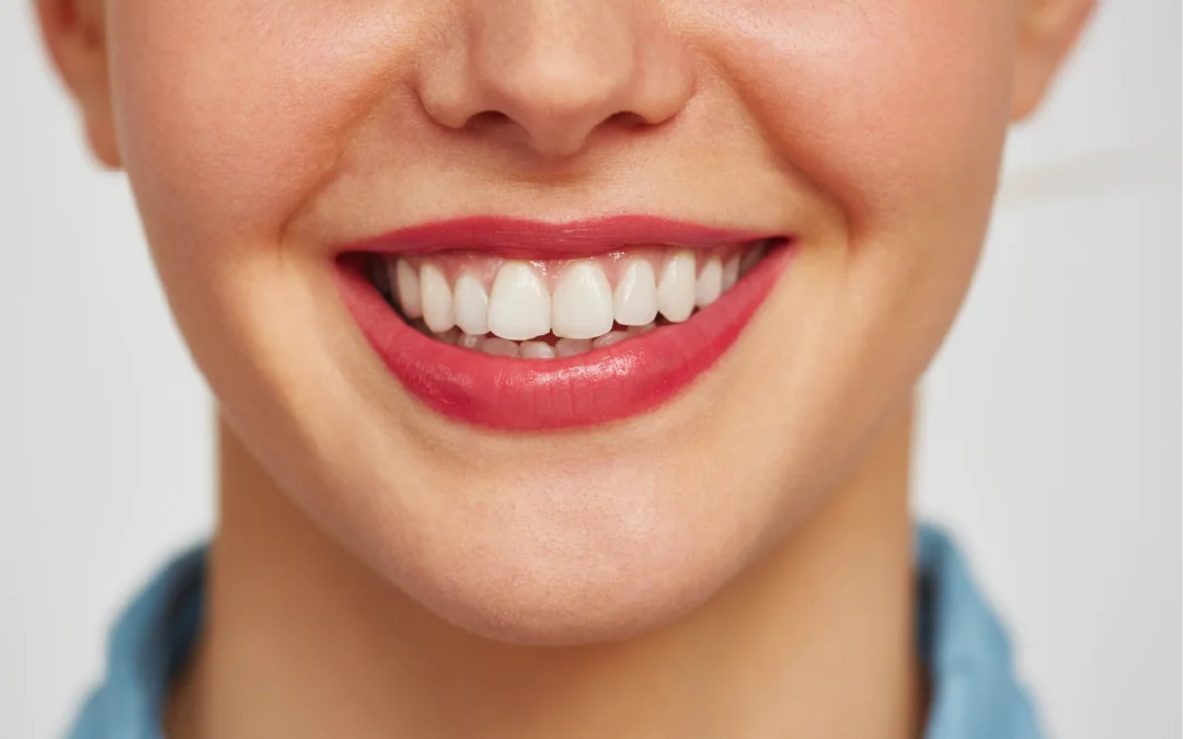 ¿Cómo afecta el refresco a tus dientes? Conoce los efectos del refresco en el esmalte dental